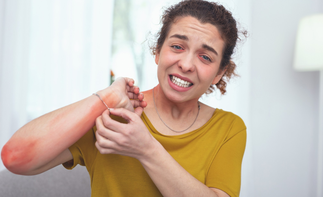 When Your Skin Speaks Loudly: A Homeopathic Look at Psoriasis