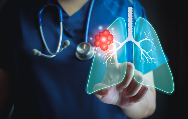 Respiratory Health