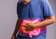 Ulcerative Colitis